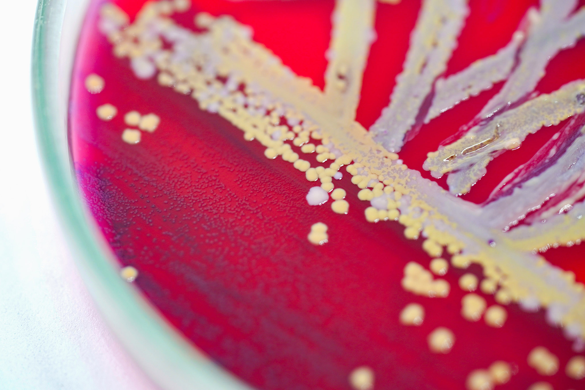 Colonie de bactéries sur une plaque de milieu de culture, microbiologie.